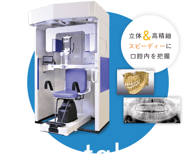 立体＆高精細 スピーディーに口腔内を把握