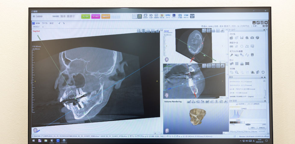 治療計画の立案・ご説明
