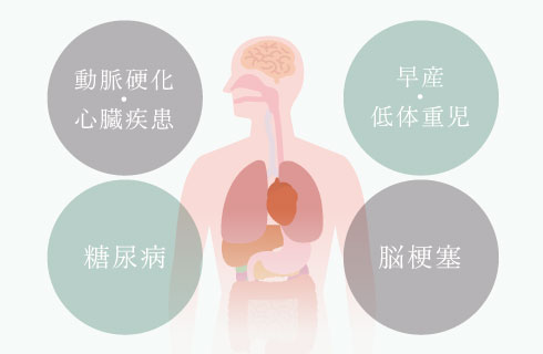 動脈硬化・心臓疾患 
						、早産・低体重児、糖尿病、脳梗塞